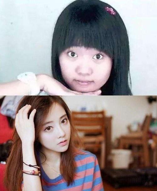 爆料小姨整容视频,揭秘网红级蜕变过程  第2张